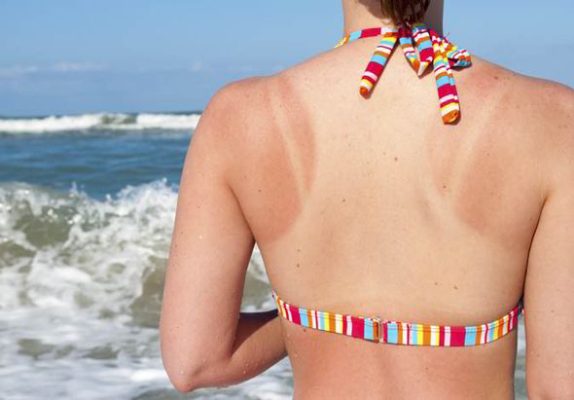 8 mẹo tránh cháy nắng và say sóng